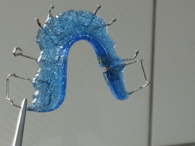 Orthodontics in Correcting Misaligned Teeth