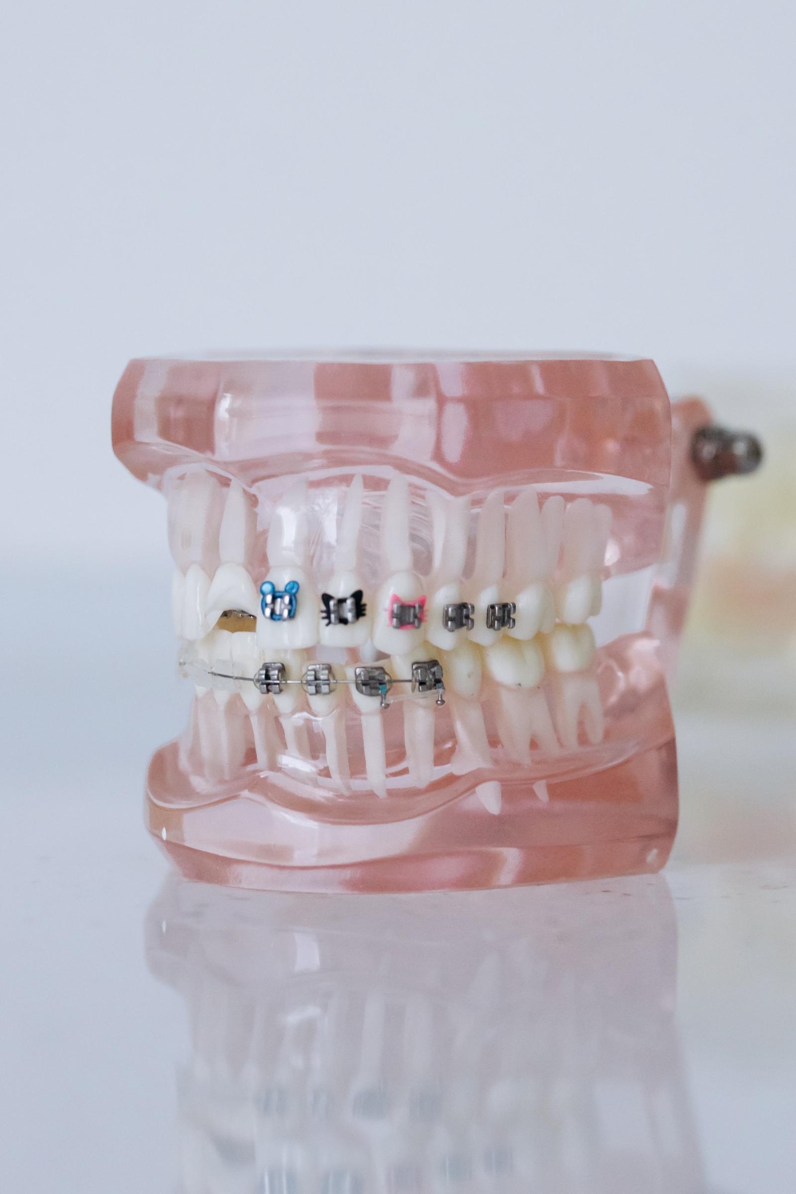 Straight Teeth & Invisalign. Chandler Cosmetic Dentist
