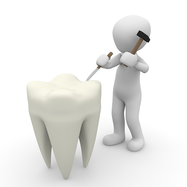 Affordable Family Dentist Gilbert. What Causes Tooth-Loss