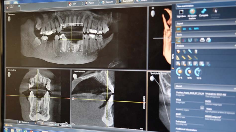 Chandler Family Dentist. What To Know About Gum Recession?