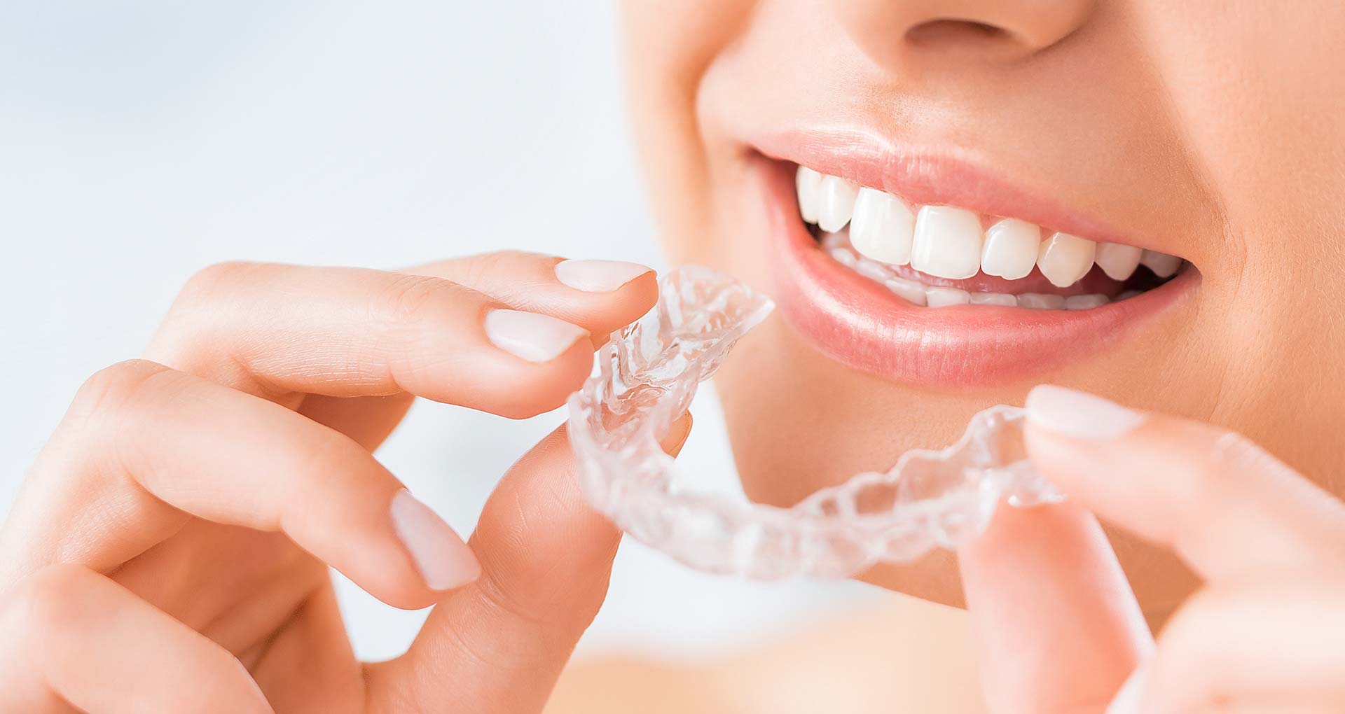 Align Teeth The New Way. Queen Creek Cosmetic Dentist