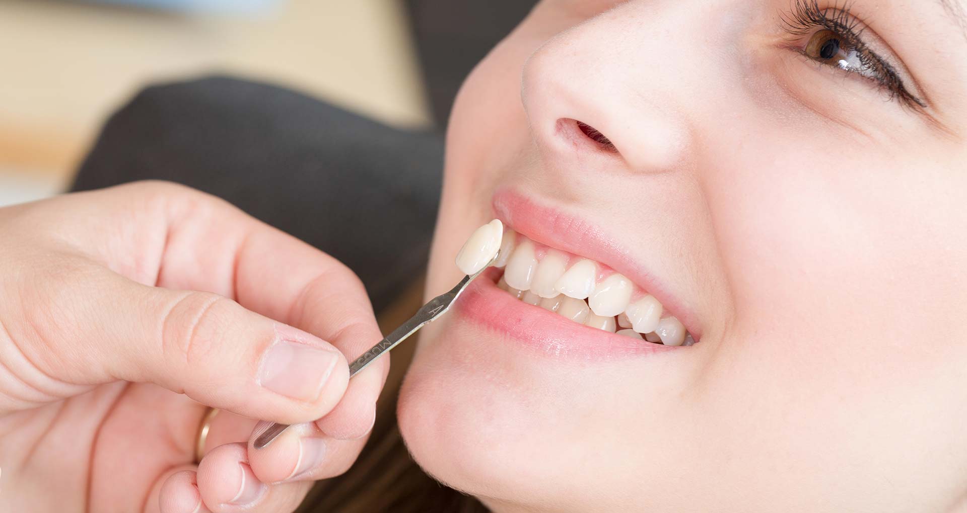 Queen Creek Cosmetic Dentist. Use Veneers To Fix Smiles
