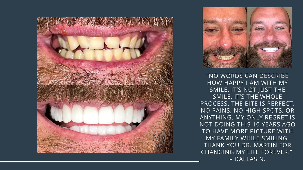 What Happens If I Delay Periodontal Disease Treatment